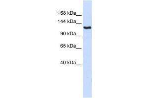 IGSF1 antibody used at 1 ug/ml to detect target protein. (IGSF1 antibody  (N-Term))