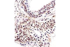 Paraformaldehyde-fixed, paraffin embedded human prostate tissue, Antigen retrieval by boiling in sodium citrate buffer (pH6. (H2AFX antibody)