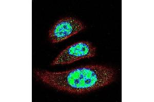 Confocal immunofluorescent analysis of EII Antibody (C-term) 11233b with A549 cell followed by Alexa Fluor 488-conjugated goat anti-rabbit lgG (green). (TDP2 antibody  (C-Term))