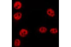 ABIN6275645 staining HepG2 by IF/ICC. (TSEN54 antibody  (Internal Region))