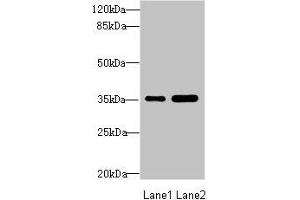 Western blot All lanes: TOB2 antibody at 1. (TOB2 antibody  (AA 1-70))