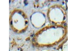 Used in DAB staining on fromalin fixed paraffin-embedded Kidney tissue (CD3D antibody  (AA 18-113))