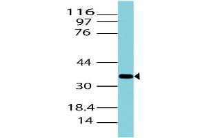 Image no. 1 for anti-Arginase (ARG) (AA 4-230) antibody (ABIN5027037) (ARG antibody  (AA 4-230))