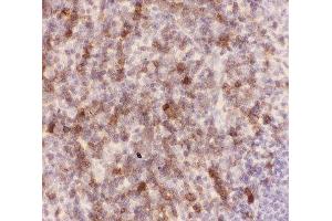 IHC-P: CD43 antibody testing of mouse spleen tissue