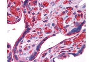 UCHL3 antibody was used for immunohistochemistry at a concentration of 4-8 ug/ml. (UCHL3 antibody)
