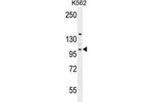VILL Antibody (Center) western blot analysis in K562 cell line lysates (35 µg/lane). (VILL antibody  (Middle Region))