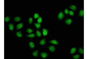Immunofluorescence staining of Hela cells with ABIN7153843 at 1:133, counter-stained with DAPI. (GANP antibody  (AA 292-435))