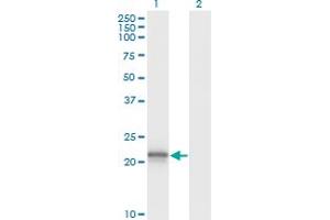 Western Blot analysis of VHL expression in transfected 293T cell line by VHL monoclonal antibody (M01), clone 1G12. (VHL antibody  (AA 1-110))