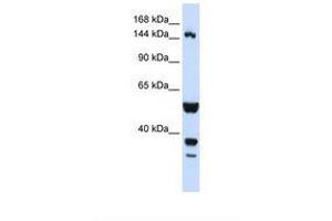 Image no. 1 for anti-ABI Family, Member 3 (NESH) Binding Protein (ABI3BP) (AA 144-193) antibody (ABIN6738309) (ABI3BP antibody  (AA 144-193))