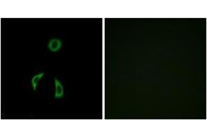 Immunofluorescence analysis of A549 cells, using FZD3 Antibody. (FZD3 antibody  (AA 481-530))
