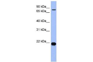 WB Suggested Anti-ZNF800 Antibody Titration:  0. (ZNF800 antibody  (N-Term))