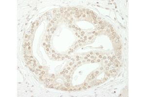 Immunohistochemistry (IHC) image for anti-Zinc Finger and BTB Domain Containing 40 (ZBTB40) (AA 1140-1190) antibody (ABIN7448873)