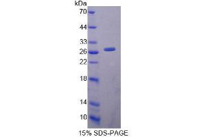 SDS-PAGE analysis of Mouse LYPLA1 Protein.