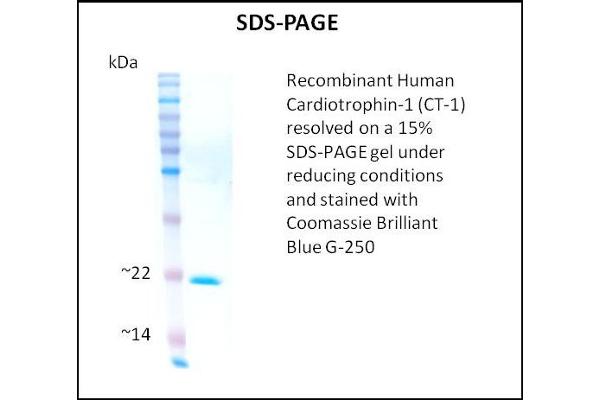 Cardiotrophin 1 Protein (CTF1)