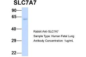 Host:  Rabbit  Target Name:  SLC7A7  Sample Type:  Human Fetal Lung  Antibody Dilution:  1. (SLC7A7 antibody  (Middle Region))