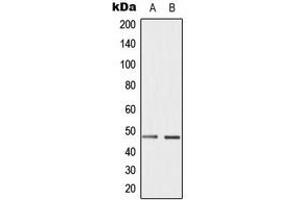 Western blot analysis of Cyclin E1 (pT395) expression in HepG2 (A), JAR (B) whole cell lysates. (Cyclin E1 antibody  (C-Term, pSer395))