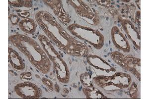 Image no. 2 for anti-Carboxypeptidase A1 (Pancreatic) (CPA1) (AA 1-419) antibody (ABIN1490772)