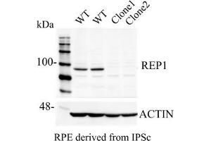 Western Blotting (WB) image for anti-Choroideremia (Rab Escort Protein 1) (CHM) (C-Term) antibody (ABIN6254222) (CHM antibody  (C-Term))