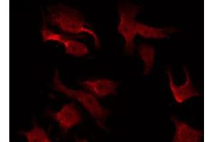 ABIN6267473 staining Hela by IF/ICC. (AKT1 antibody  (pThr308))
