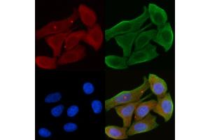 ABIN6265855 and ABIN6272453 staining Hela cells(30 min of UV treatment) by IF/ICC.