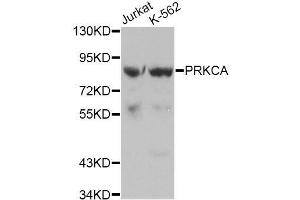 Western blot analysis of extracts of various cell lines, using PRKCA antibody. (PKC alpha antibody  (C-Term))