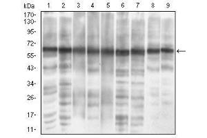 Western blot analysis using EIF2A mouse mAb against MCF-7 (1), PC-12 (2), HepG2 (3), Hela (4), Cos7 (5), K562 (6), Jurkat (7), A431 (8) and NIH/3T3 (9) cell lysate.