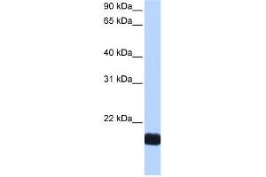 WB Suggested Anti-CTF1 Antibody Titration: 0. (Cardiotrophin 1 antibody  (N-Term))