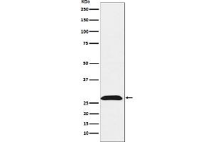 Western blot analysis of RhoGDI expression in HeLa cell lysate.