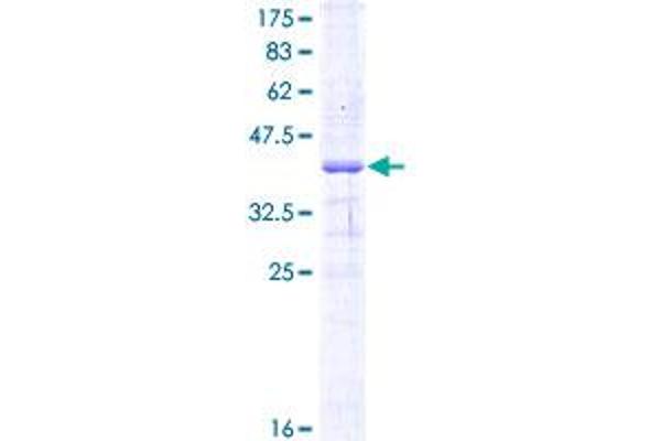 IL28RA Protein (AA 51-150) (GST tag)