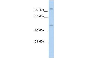 WB Suggested Anti-NR3C1 AntibodyTitration: 1. (Glucocorticoid Receptor antibody  (N-Term))
