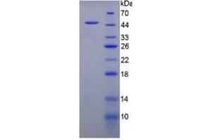SDS-PAGE of Protein Standard from the Kit  (Highly purified E. (MUC1 ELISA Kit)