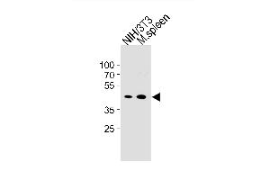 Mouse CCNB1 Antibody (Center /) (ABIN1881515 and ABIN2843319) western blot analysis in mouse NIH/3T3 cell line and mouse spleen tissue lysates (35 μg/lane). (Cyclin B1 antibody  (AA 103-130))