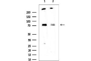 Western blot analysis of lysates from various samples, using Phospho-Ezrin (Thr567) Mouse Monoclonal Antibody at 1/1000 dilution.