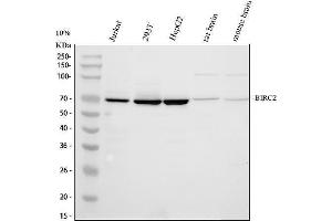 Western blot analysis of cIAP1/BIRC2 using anti-cIAP1/BIRC2 antibody (ABIN5693185). (BIRC2 antibody  (AA 320-570))