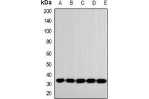 Western blot analysis of Latexin expression in 22RV1 (A), MCF7 (B), HT29 (C), BT474 (D), mouse heart (E) whole cell lysates. (Latexin antibody)