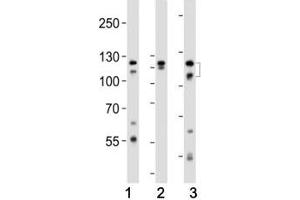 Western Blotting (WB) image for anti-Fibroblast Growth Factor Receptor 2 (FGFR2) (AA 7-37) antibody (ABIN3030951)