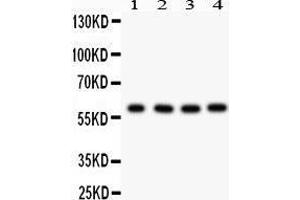 Western Blotting (WB) image for anti-Parafibromin (CDC73) (AA 119-520) antibody (ABIN3043535) (HRPT2 antibody  (AA 119-520))