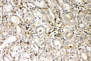 IHC analysis of S100A4 using anti-S100A4 antibody (ABIN7600462). (s100a4 antibody  (AA 2-101))