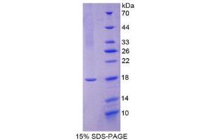 SDS-PAGE (SDS) image for Chorionic Gonadotropin, beta Polypeptide (CGB) (AA 31-165) protein (His tag) (ABIN2124333)