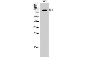 Western Blotting (WB) image for anti-Immunoglobulin kappa Variable 1-27 (IGKV1-27) (Internal Region) antibody (ABIN3173607) (IGKV1-27 antibody  (Internal Region))