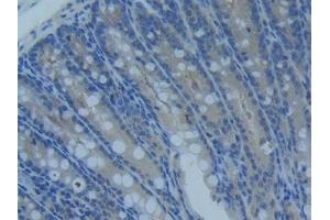 Detection of MMP14 in Mouse Intestine Tissue using Polyclonal Antibody to Matrix Metalloproteinase 14 (MMP14) (MMP14 antibody  (AA 121-487))