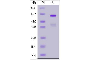 Human CD74, Fc Tag on  under reducing (R) condition. (CD74 Protein (AA 73-232) (Fc Tag))