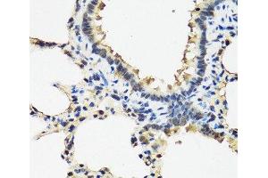 Immunohistochemistry of paraffin-embedded Rat lung using ARSF Polyclonal Antibody at dilution of 1:100 (40x lens). (ARSF antibody)