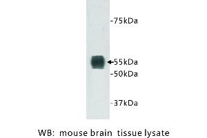 Image no. 1 for anti-Transmembrane Protein 132A (TMEM132A) antibody (ABIN1112938) (TMEM132A antibody)