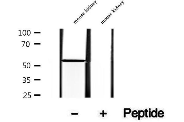 ALDH7A1 antibody  (C-Term)
