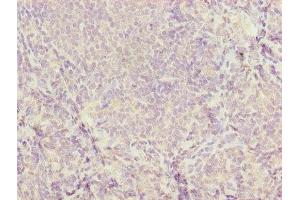 Immunohistochemistry of paraffin-embedded human tonsil tissue using ABIN7177453 at dilution of 1:100 (CD46 antibody  (AA 45-329))