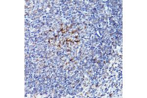 Immunohistochemistry of paraffin-embedded mouse spleen using BOK Rabbit pAb (ABIN7265866) at dilution of 1:100 (40x lens).