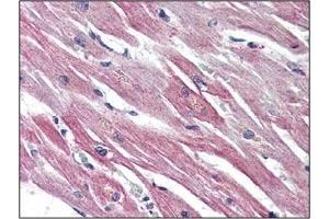Immunohistochemistry: EPHX2 antibody staining of Formalin-Fixed, Paraffin-Embedded Human Heart. (EPHX2 antibody  (C-Term))
