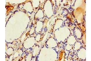 Immunohistochemistry of paraffin-embedded human thyroid tissue using ABIN7164255 at dilution of 1:100 (SLMO2 antibody  (AA 1-194))