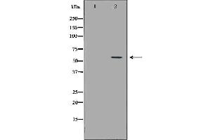 Western blot analysis of Hepg2 whole cell lysates, using CEACAM1 Antibody. (CEACAM1 antibody  (C-Term))